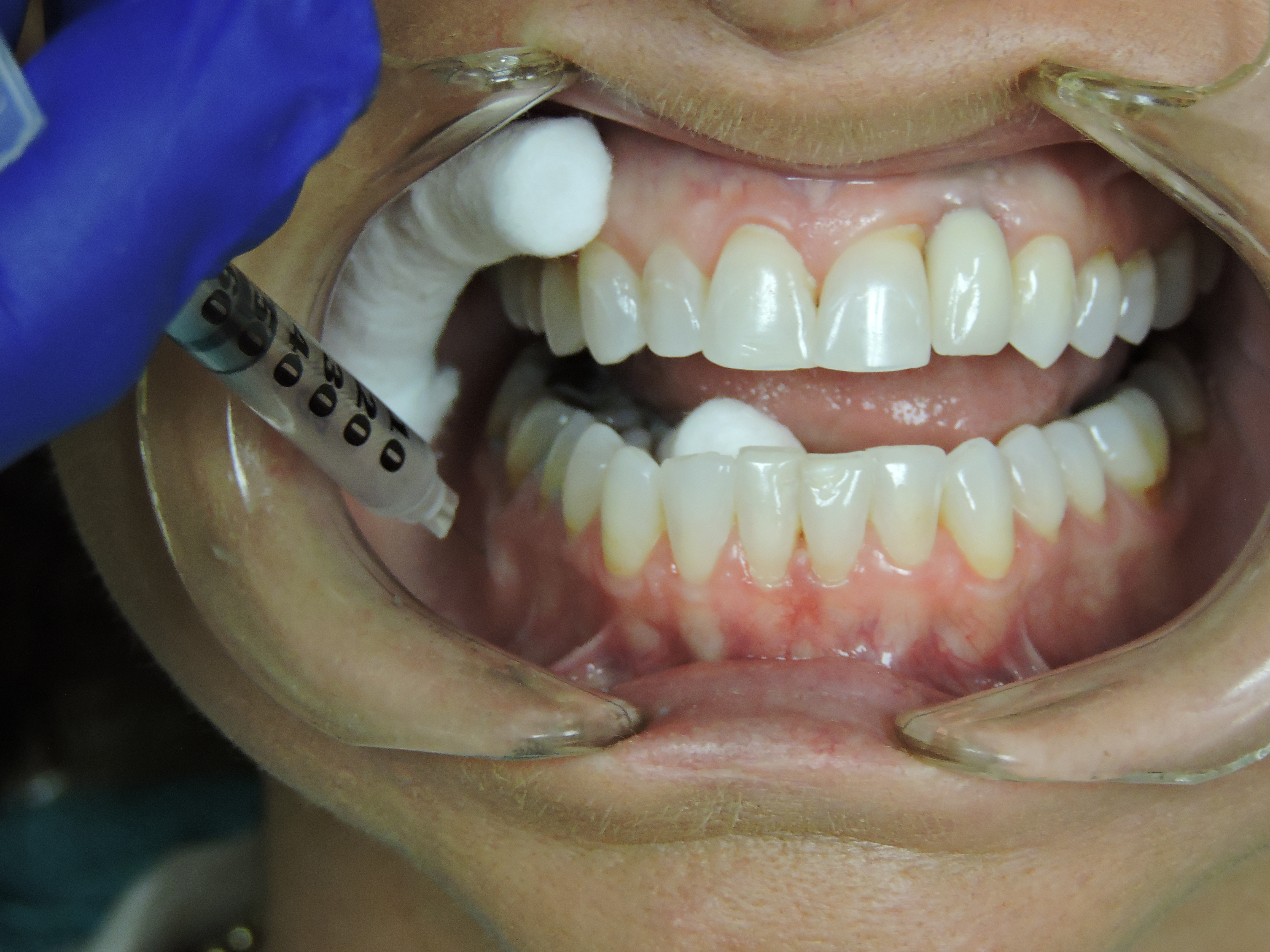 Papilla regeneration isolation